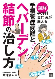 図解 手外科専門医が教える 手根管症候群とヘバーデン結節の治し方 最新刊 無料試し読みなら漫画 マンガ 電子書籍のコミックシーモア 図解 手外科専門医が教える 手根管症候群とヘバーデン結節の治し方 最新刊 無料試し読みなら漫画 マンガ 電子書籍のコミックシーモア